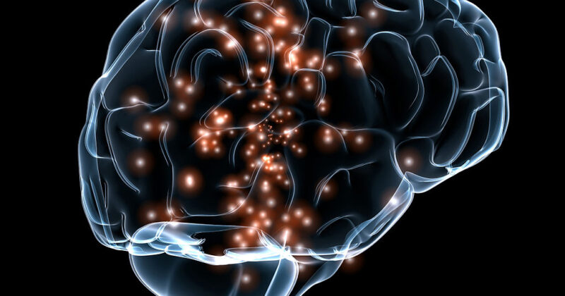 cerebro