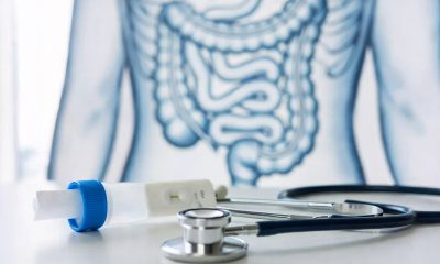 câncer de intestino