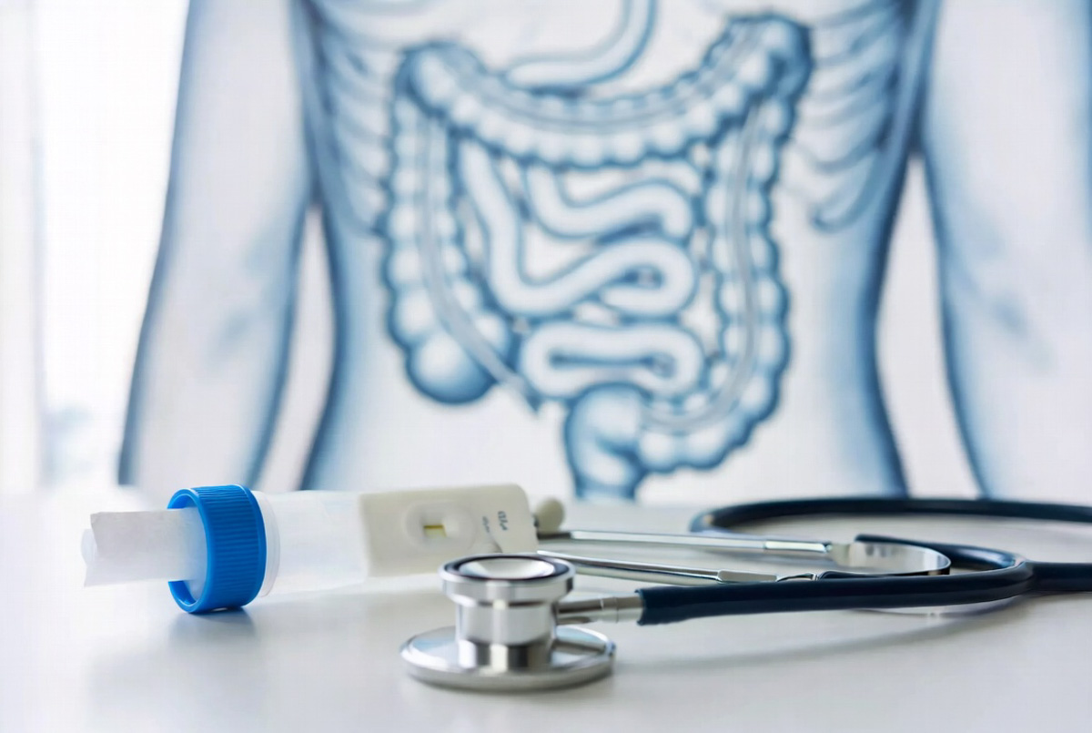 câncer de intestino